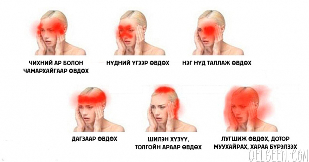 Толгой аль хэсгээрээ, яаж өвдөж байгаагаас хамаарч эрүүл мэндэд ямар ...