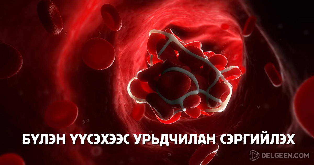 Энэхүү мэдээллийг уншсанаар та цус өтгөрөхөөс хэрхэн урьдчилан ...